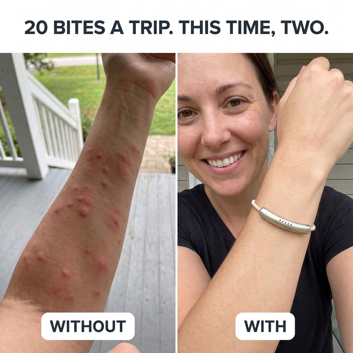 20 bites a trip before. Two bites with Roone.